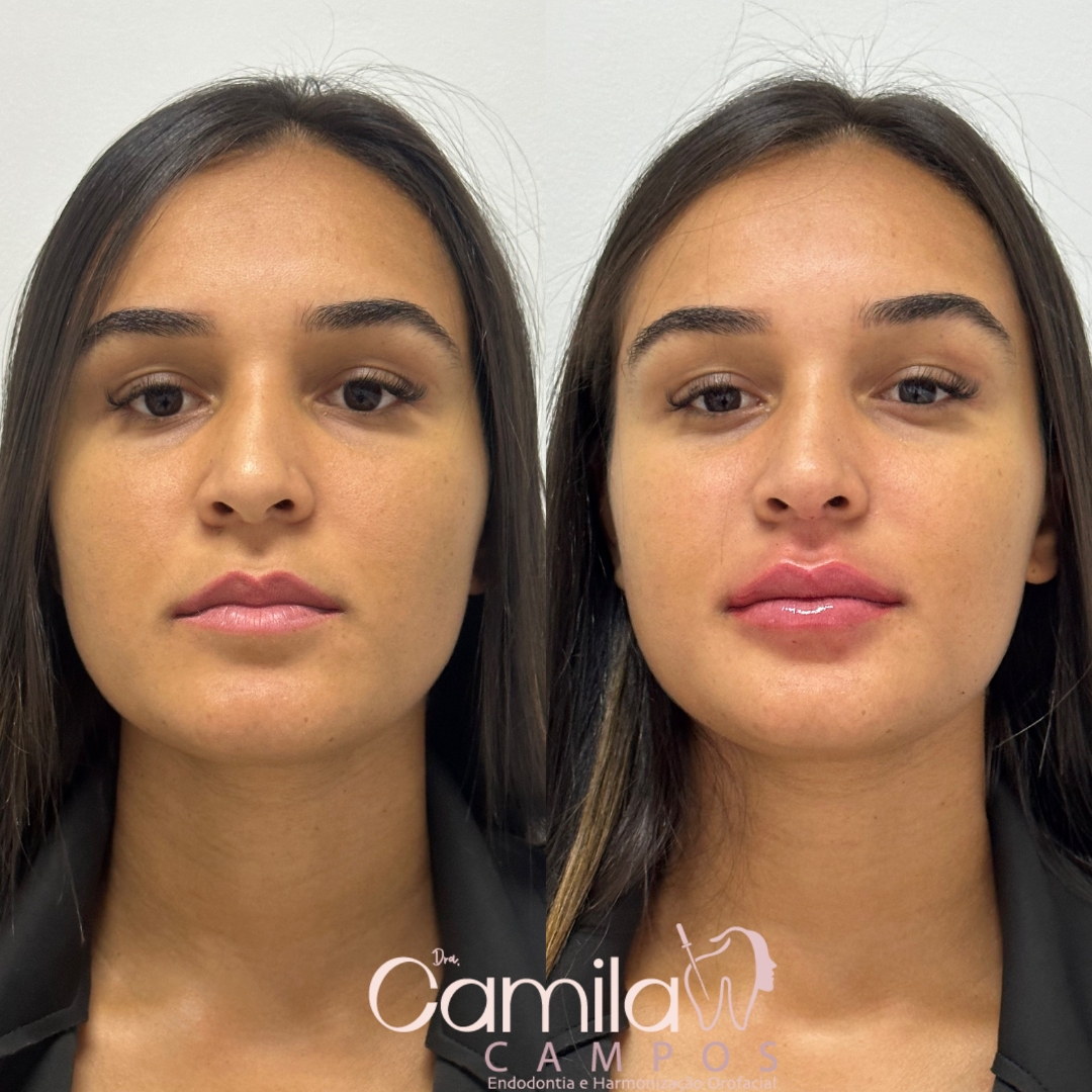 Labios